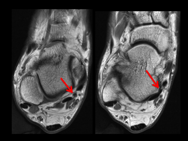Figure 2 for case accessory FHL